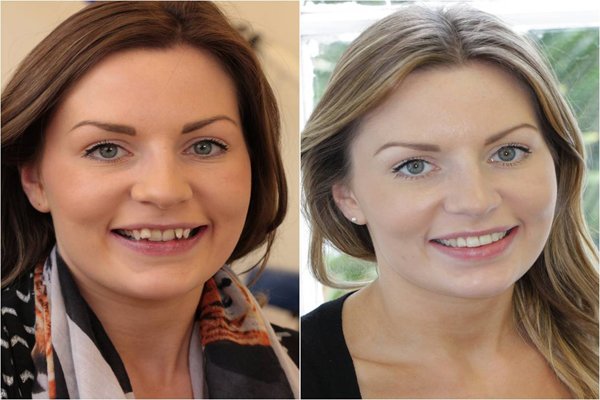 glenview dental treatment